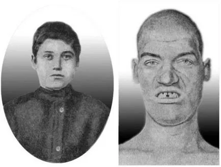 Az agyalapi mirigy az agyban, hogy