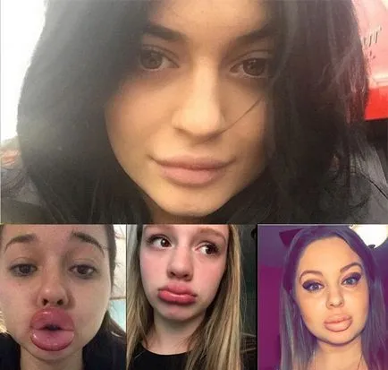 Lips, mint egy kacsa Lips, mint egy kacsa
