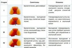 Gyertyák ihtiola amit Gyertyák ihtiola amit