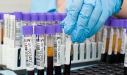 Hogyan működik bronchitis