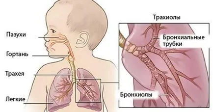 Hogyan működik bronchitis