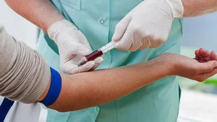 Hogyan bérelni egy közös vérvizsgálat Hogyan bérelni egy közös vérvizsgálat