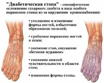 Diabetikus lábápoló Diabetikus lábápoló