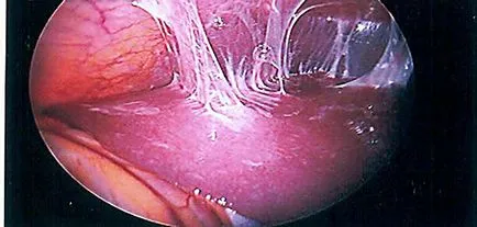 Chlamydia és a terhesség kezelés Chlamydia és a terhesség kezelés