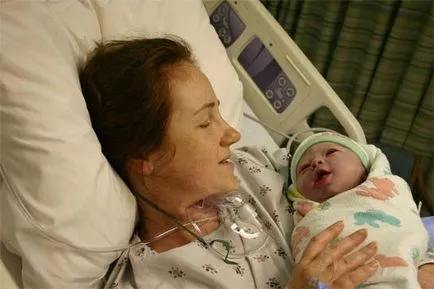 A rossz császármetszés