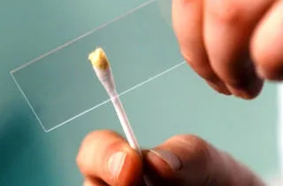 Hogyan kell szedni a teszt staphylococcus