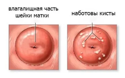 OV naboti meg OV naboti meg