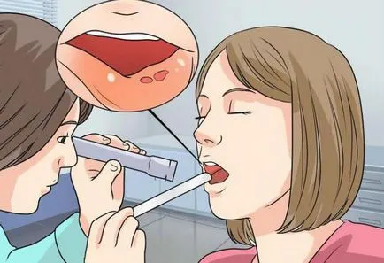 Mi segítséget stomatitis Mi segítséget stomatitis