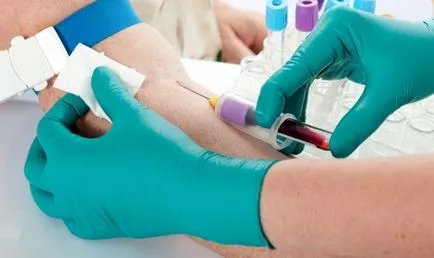 Hogyan bérelni egy közös vérvizsgálat