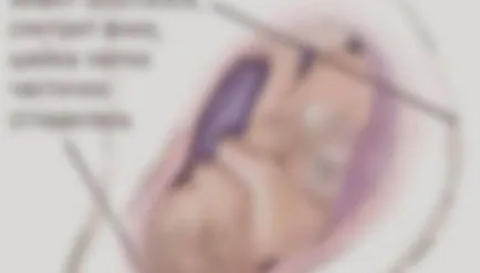 Mivel a gyomor kezd esni Mivel a gyomor kezd esni