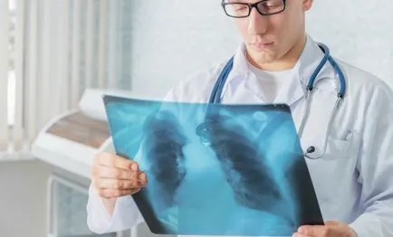 Hogyan működik bronchitis