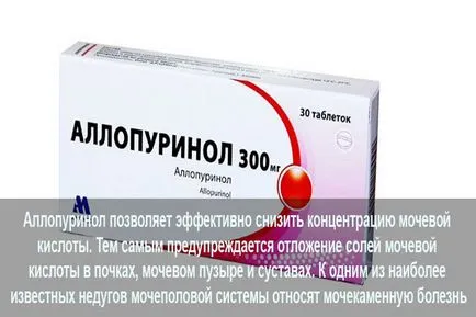 Azt jelenti, kezelésére urolithiasis