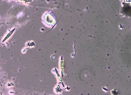 Treponema pallidum meg Treponema pallidum meg