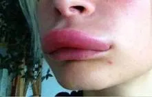 Lips, mint egy kacsa
