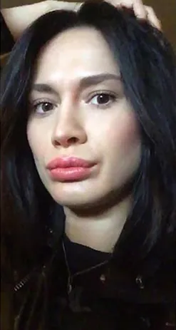 Lips, mint egy kacsa