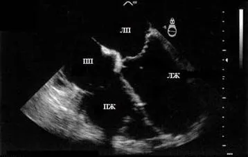 Mi echokardiogramot Mi echokardiogramot