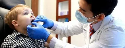 Tömítő fogak gyermekeknél vélemények arról, hogy ezt a Barázdazárás szüksége