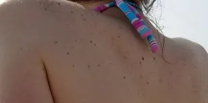 Miért ugrás mol