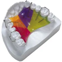 Javítás fogak (elzáródás), anélkül, nadrágtartó - okai, tünetei és kezelése (fog harapni zárójelben) Javítás a fogak (malocclusion) nélkül nadrágtartó - okai, tünetei és kezelése