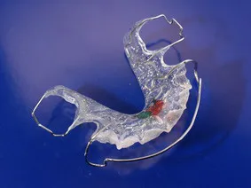 Javítás a fogak (malocclusion) nélkül nadrágtartó - okai, tünetei és kezelése (okklúziós) Javítás a fogak (malocclusion) nélkül nadrágtartó - okai, tünetei és kezelése