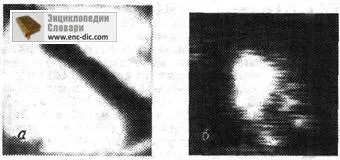 Introscopy - Encyclopedia & amp; szótárak