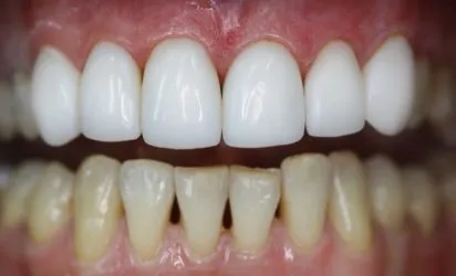 Malocclusion áttekintést ad a jelenlegi módszerek