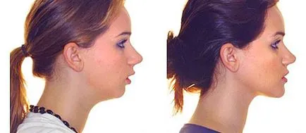 Malocclusion felnőtt kezelések és az árak, dentalsolution fogászati szolgáltatások (kezelés) Malocclusion felnőtt kezelések és árak, fogászat szolgáltatások dentalsolution