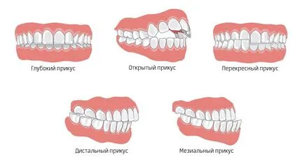 Malocclusion felnőtt kezelések és az árak, dentalsolution fogászati szolgáltatások (korrekció) Malocclusion felnőtt kezelések és árak, fogászat szolgáltatások dentalsolution