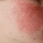 Hogyan szúr inzulint a gyomorban, ahol az injekciót a fecskendő videók