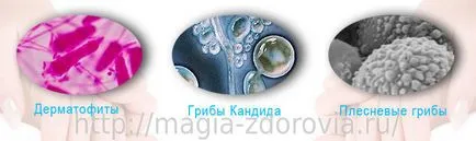 Hogyan működik egy gomba Hogyan működik egy gomba