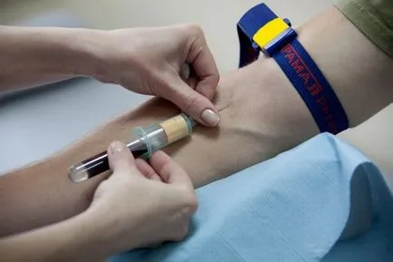 Hogy nem lehet megenni, mielőtt a vérvizsgálat