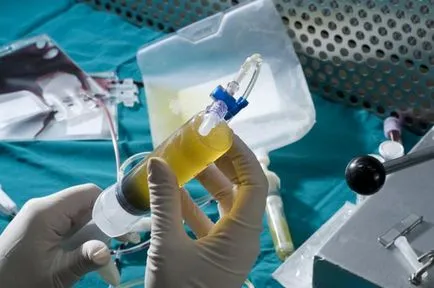Hogyan lesz egy csontvelő donor Magyarországon (Magyarország) Hogyan lesz egy csontvelő donor Magyarországon