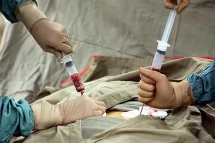 Hogyan lesz egy csontvelő donor Magyarországon (csont) Hogyan lesz egy csontvelő donor Magyarországon