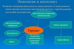 Autoimmun pajzsmirigy betegség okai, tünetei (autoimmun) Autoimmun pajzsmirigy betegség tüneteket okoz