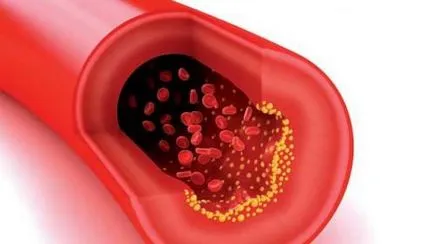A menstruáció nem ér véget az oka rendellenes menstruációs ciklus