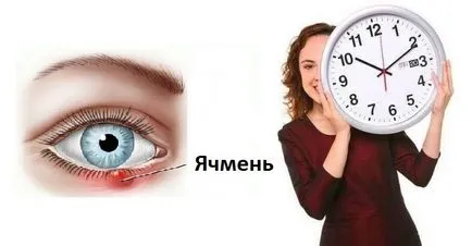 Ez nem disznóól, meddig és mennyit megy át (a szem) Elmulasztja árpa mennyi ideig és hány kerül sor