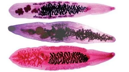 Opisthorchiasis milyen opistorhisov paraziták emberben (opisthorchiasis) Opisthorchiasis milyen opistorhisov paraziták emberben