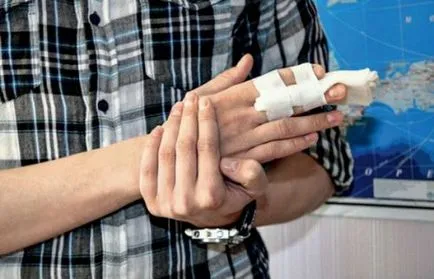 A törött ujját a kar és a láb tünetek, hogyan kell meghatározni a kezelés