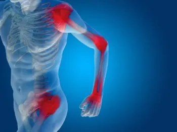 Arthritis - tünetek és a kezelés, az okok (tünetek) Arthritis - tünetek és a kezelés, okai