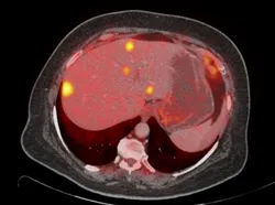 A különbség az eljárásban MRI kontrasztanyag nélkül, és egy (kontraszt) A különbség az MRI eljárást anélkül, hogy a kontraszt és a kontraszt