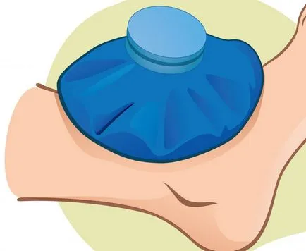 Szünet, és nyújtás az izmok okok, típusok, a tünetek, a kezelés (izomtónus) Szünet és stretching izmok okok, típusok, tünetek, kezelés