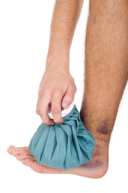 A rés boka szalagok - kezelés és diagnosztika, hogy megtudja!