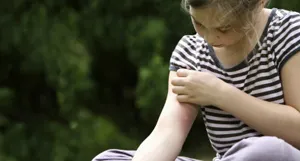 Szúnyogcsípés eltávolítására ödéma kezelés és a gondozás a gyermekek számára (segítség) Szúnyogcsípés eltávolítására ödéma kezelés és a gondozás a gyermekek számára