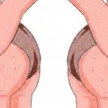 akne allergia