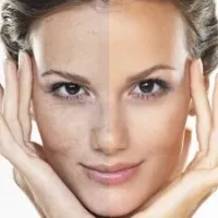 Peeling otthon gyümölcssavak