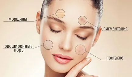 Peeling otthon gyümölcssavak