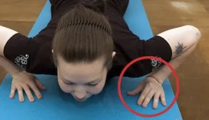 Hygroma ecset kezelés Hygroma ecset kezelés
