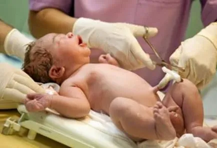 Hogyan határozzák meg a magzat, vagy sem Hogyan határozzák meg a magzat, vagy sem