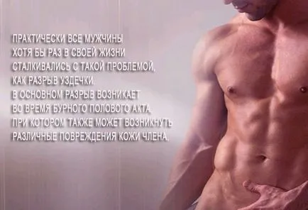 Mi köze van egy kantár