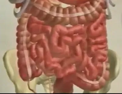 A kezelt dysbiosis